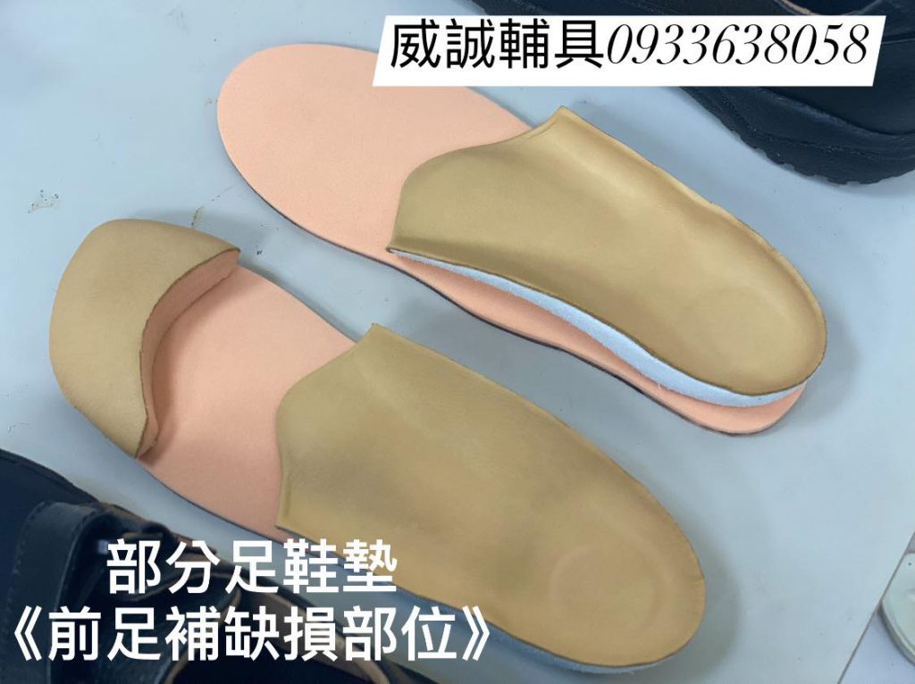 #部分足義肢 #訂製鞋墊 #健保給付無自費