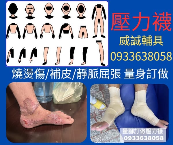 壓力襪