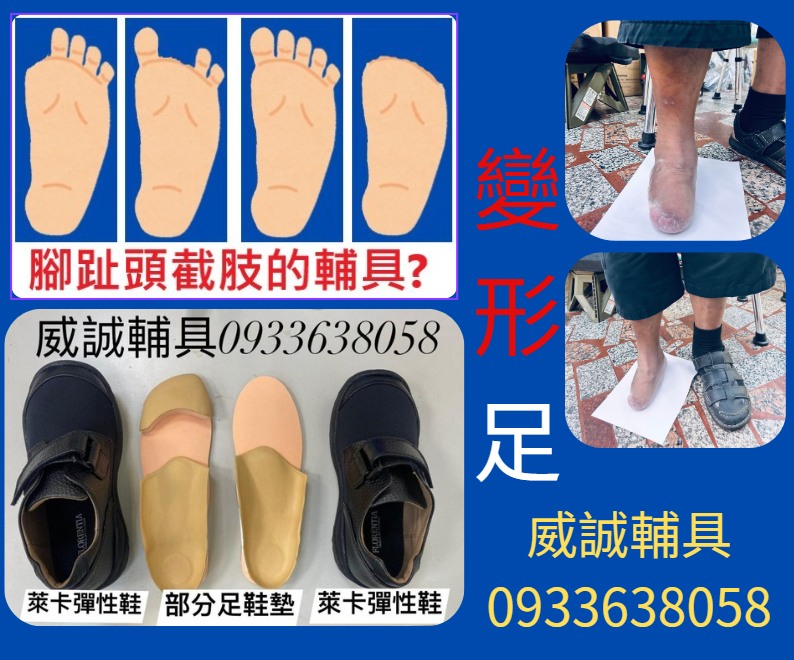 截肢